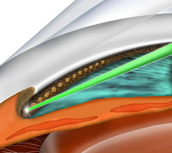 Immagine 2025-11-17 011715 Immagine 2025-11-17 011715